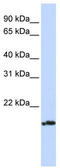 P2 antibody, TA334453, Origene, Western Blot image 