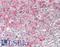 CD1d Molecule antibody, LS-B12894, Lifespan Biosciences, Immunohistochemistry paraffin image 