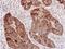 L1 Cell Adhesion Molecule antibody, PA5-78037, Invitrogen Antibodies, Immunohistochemistry paraffin image 