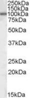 Zinc Finger E-Box Binding Homeobox 1 antibody, PA5-19078, Invitrogen Antibodies, Western Blot image 