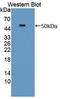 Hyaluronidase 1 antibody, LS-C373866, Lifespan Biosciences, Western Blot image 