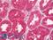 Annexin A3 antibody, LS-B12273, Lifespan Biosciences, Immunohistochemistry paraffin image 