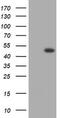 Gamma-Butyrobetaine Hydroxylase 1 antibody, TA505748AM, Origene, Western Blot image 
