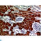 Drosha Ribonuclease III antibody, LS-C813502, Lifespan Biosciences, Immunohistochemistry paraffin image 