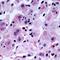 NDRG Family Member 4 antibody, LS-C368920, Lifespan Biosciences, Immunohistochemistry paraffin image 