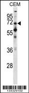 Protein Phosphatase With EF-Hand Domain 1 antibody, 57-703, ProSci, Western Blot image 