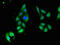 Serine/threonine-protein kinase 35 antibody, CSB-PA851552LA01HU, Cusabio, Immunofluorescence image 