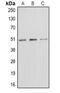 E2F-1 antibody, MBS821666, MyBioSource, Western Blot image 