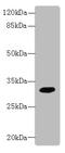 Phosphatidylinositol-4,5-Bisphosphate 4-Phosphatase 2 antibody, A61430-100, Epigentek, Western Blot image 