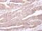 Protein Tyrosine Phosphatase Non-Receptor Type 1 antibody, GTX106104, GeneTex, Immunohistochemistry paraffin image 