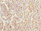 BCL2 Interacting Protein 1 antibody, LS-C675426, Lifespan Biosciences, Immunohistochemistry paraffin image 