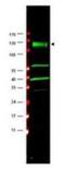 FA Complementation Group A antibody, NBP1-03286, Novus Biologicals, Western Blot image 