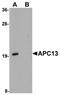 Anaphase Promoting Complex Subunit 13 antibody, orb75416, Biorbyt, Western Blot image 