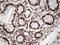 Tripartite Motif Containing 28 antibody, LS-C796558, Lifespan Biosciences, Immunohistochemistry paraffin image 