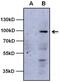 Aryl Hydrocarbon Receptor antibody, MA1-513, Invitrogen Antibodies, Western Blot image 