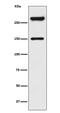 Spectrin alpha chain, brain antibody, M03831-2, Boster Biological Technology, Western Blot image 