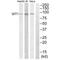 GIT ArfGAP 1 antibody, A02140, Boster Biological Technology, Western Blot image 