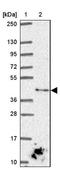 Docking Protein 5 antibody, NBP2-39051, Novus Biologicals, Western Blot image 