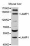 Lysosomal Associated Membrane Protein 1 antibody, STJ113156, St John