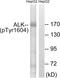 ALK p80 antibody, GTX16377, GeneTex, Western Blot image 