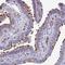Tetratricopeptide Repeat Domain 30A antibody, HPA052100, Atlas Antibodies, Immunohistochemistry paraffin image 