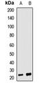 Neurotrophin 4 antibody, LS-C668625, Lifespan Biosciences, Western Blot image 