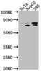 SRSF Protein Kinase 2 antibody, CSB-PA022683LA01HU, Cusabio, Western Blot image 