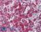 Sushi domain-containing protein 2 antibody, LS-A8474, Lifespan Biosciences, Immunohistochemistry paraffin image 