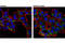 Receptor-binding cancer antigen expressed on SiSo cells antibody, 67856S, Cell Signaling Technology, Immunocytochemistry image 