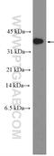 Caspase 7 antibody, 27155-1-AP, Proteintech Group, Western Blot image 