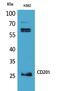 Protein C Receptor antibody, A01166, Boster Biological Technology, Western Blot image 