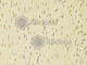 Heterogeneous nuclear ribonucleoprotein K antibody, A1701, ABclonal Technology, Immunohistochemistry paraffin image 