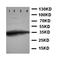 Eukaryotic Translation Initiation Factor 2 Alpha Kinase 4 antibody, orb99190, Biorbyt, Western Blot image 
