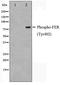 FER Tyrosine Kinase antibody, TA348428, Origene, Western Blot image 