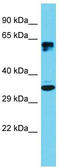 Cyclic AMP-dependent transcription factor ATF-5 antibody, TA329199, Origene, Western Blot image 