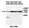 ArfGAP With GTPase Domain, Ankyrin Repeat And PH Domain 9 antibody, orb77505, Biorbyt, Western Blot image 