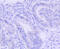 Proto-oncogene serine/threonine-protein kinase pim-1 antibody, 13-906, ProSci, Immunohistochemistry paraffin image 
