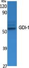 GDP Dissociation Inhibitor 1 antibody, A04179, Boster Biological Technology, Western Blot image 