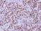 Egl nine homolog 2 antibody, GTX123033, GeneTex, Immunohistochemistry paraffin image 