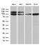 Karyopherin Subunit Beta 1 antibody, LS-C792907, Lifespan Biosciences, Western Blot image 