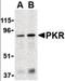 Eukaryotic Translation Initiation Factor 2 Alpha Kinase 2 antibody, orb87309, Biorbyt, Western Blot image 