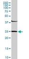 Glutathione S-Transferase Mu 4 antibody, H00002948-D01P, Novus Biologicals, Western Blot image 