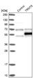 TRNA Methyltransferase 5 antibody, NBP1-82909, Novus Biologicals, Western Blot image 