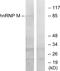 Heterogeneous Nuclear Ribonucleoprotein M antibody, A06017, Boster Biological Technology, Western Blot image 
