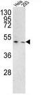 Transmembrane Serine Protease 3 antibody, GTX81644, GeneTex, Western Blot image 