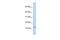 CCK8 antibody, GTX47744, GeneTex, Western Blot image 