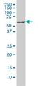 Interleukin 1 Receptor Associated Kinase 2 antibody, orb95099, Biorbyt, Western Blot image 