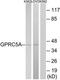 G Protein-Coupled Receptor Class C Group 5 Member A antibody, TA314849, Origene, Western Blot image 