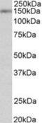 Synaptic Ras GTPase Activating Protein 1 antibody, NBP2-27558, Novus Biologicals, Western Blot image 