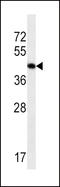 Actin Alpha 1, Skeletal Muscle antibody, LS-C155982, Lifespan Biosciences, Western Blot image 
